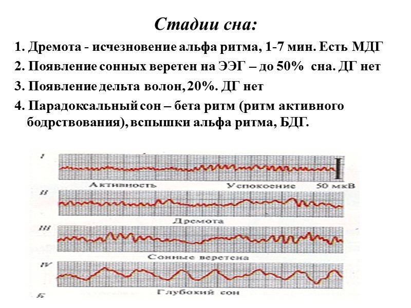 Стадии сна: 1. Дремота - исчезновение альфа ритма, 1-7 мин. Есть МДГ 2. Появление